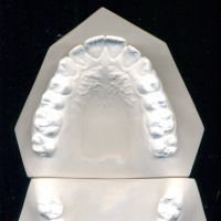 você tem um garfo? (Single)