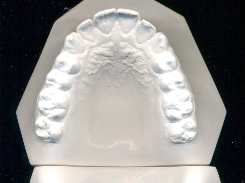 você tem um garfo? (Single)