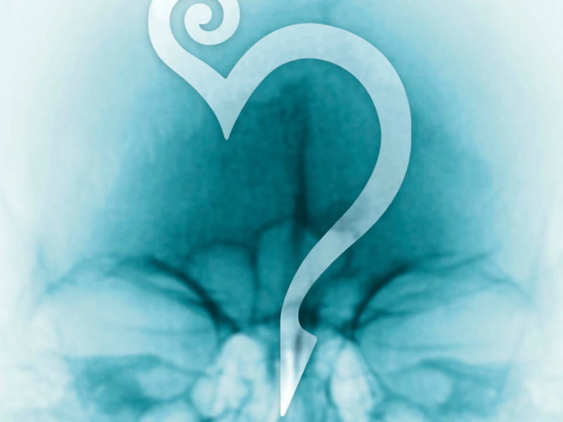 ROENTGEN (Remastered Edition 2022)