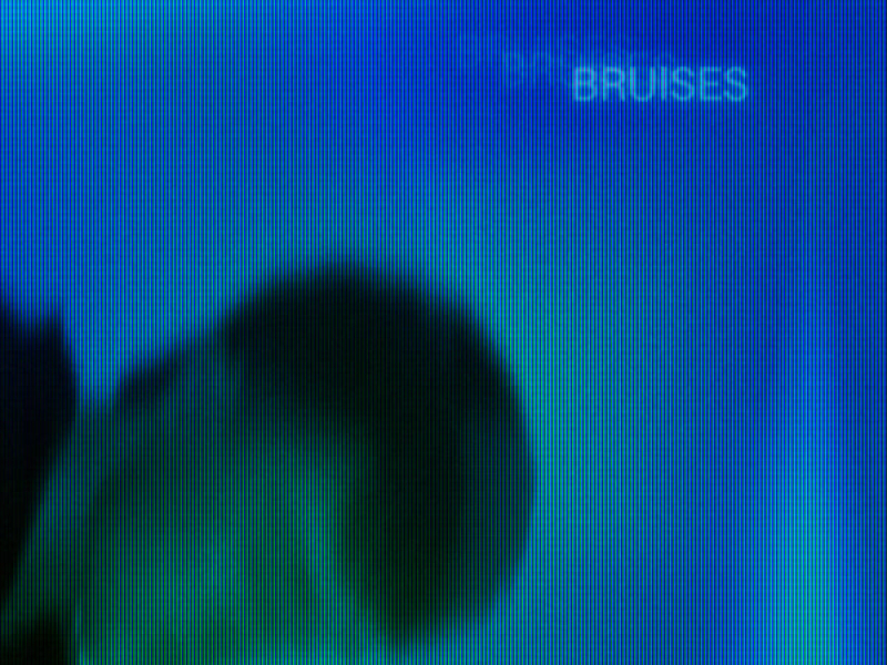 Bruises (Single)