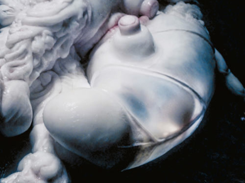 Arisen My Senses (Remixes)