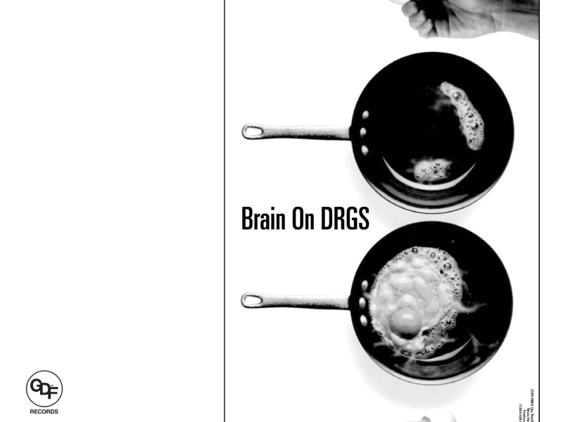 Brain on DRGS