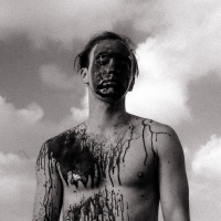 substance abuse (Single)