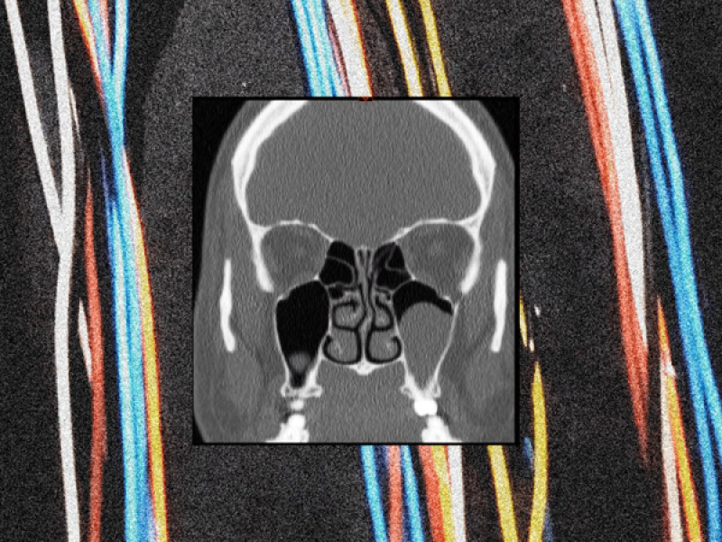 El Tiempo y La Paciencia (Single)