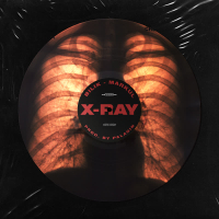 X-Ray (Single)
