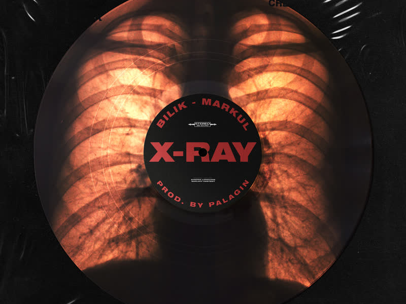 X-Ray (Single)