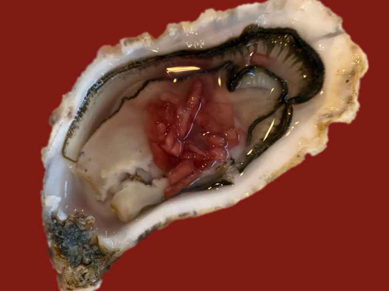 Ectopic Heart (Single)