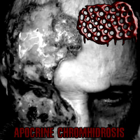 Apocrine Chromhidrosis - My Skin Is Infested With Mites And Covered In Shit (Single)