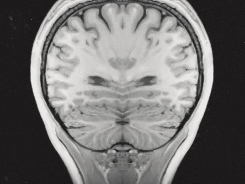 The Road Is Just a Surface