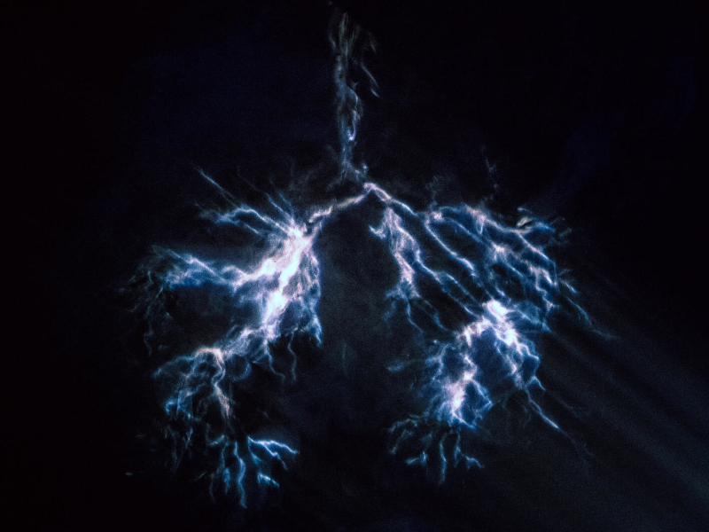 What A Miracle (Single)