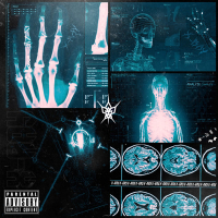 X-RAY (Single)