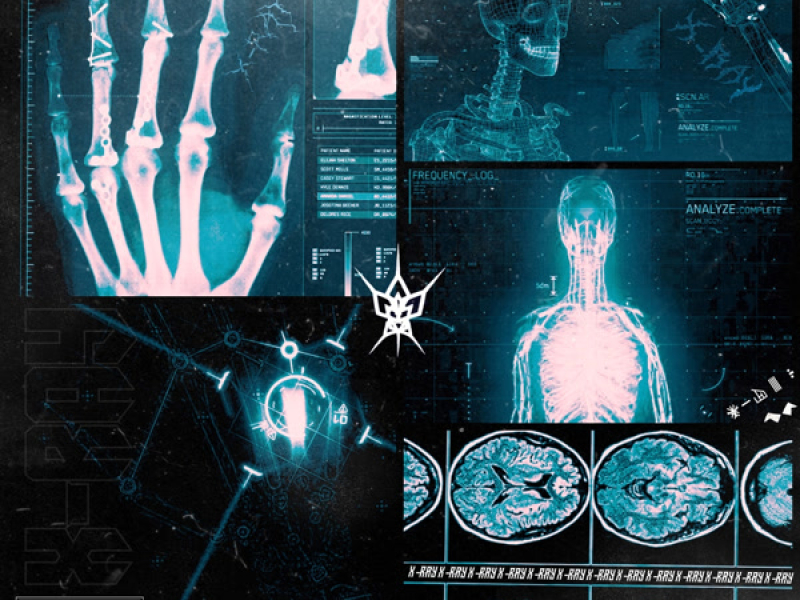 X-RAY (Single)