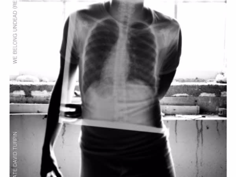 We Belong Undead Remixes