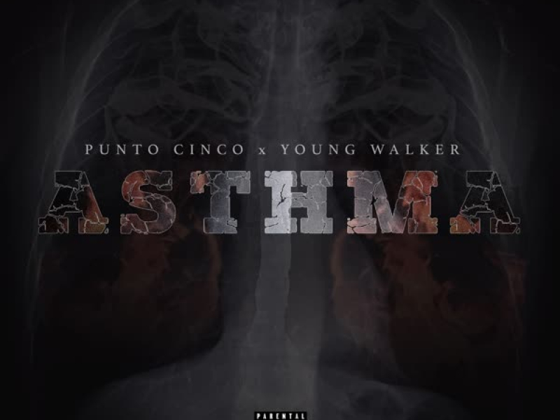 Asthma (Single)