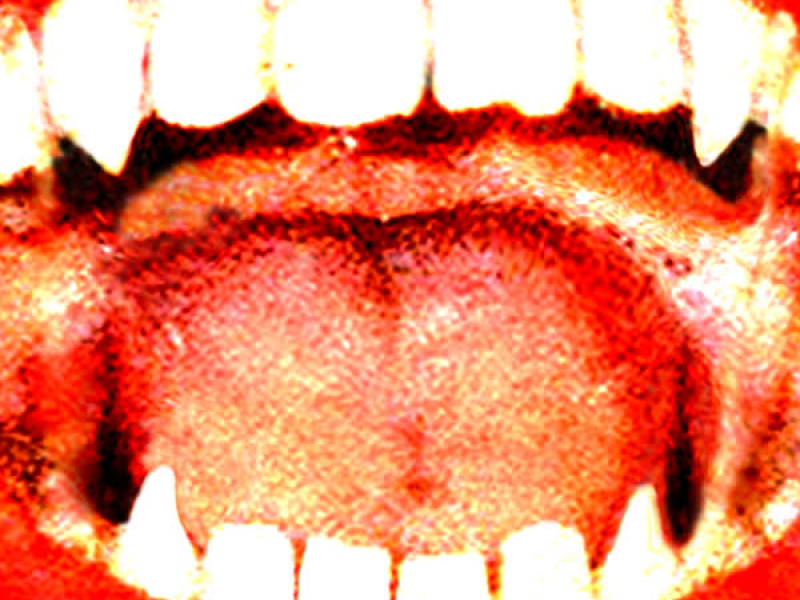 PS4(STRONG) (Single)