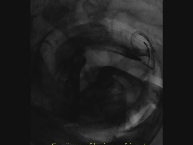 Feelings of losing a friend (Single)