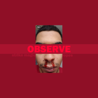 Observe (Single)