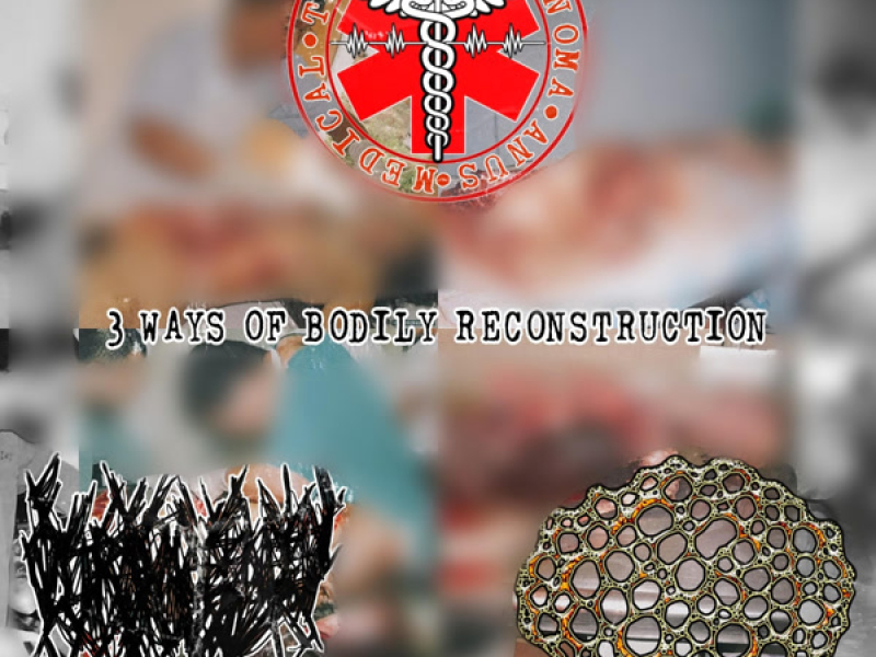 3 WAYS OF BODILY RECONSTRUCTION (EP)