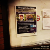 Scratches On Your Face (Single)