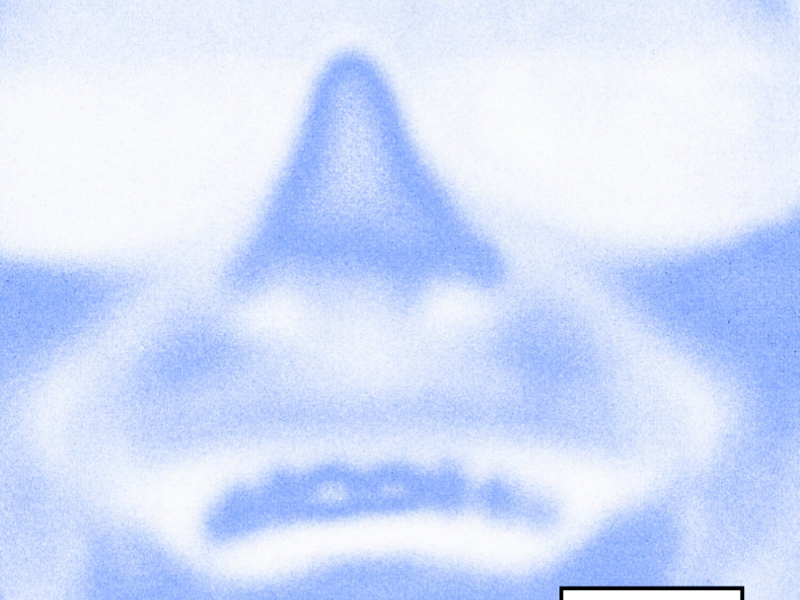 Molly in Mexico (Mr. Tophat Remix) (EP)