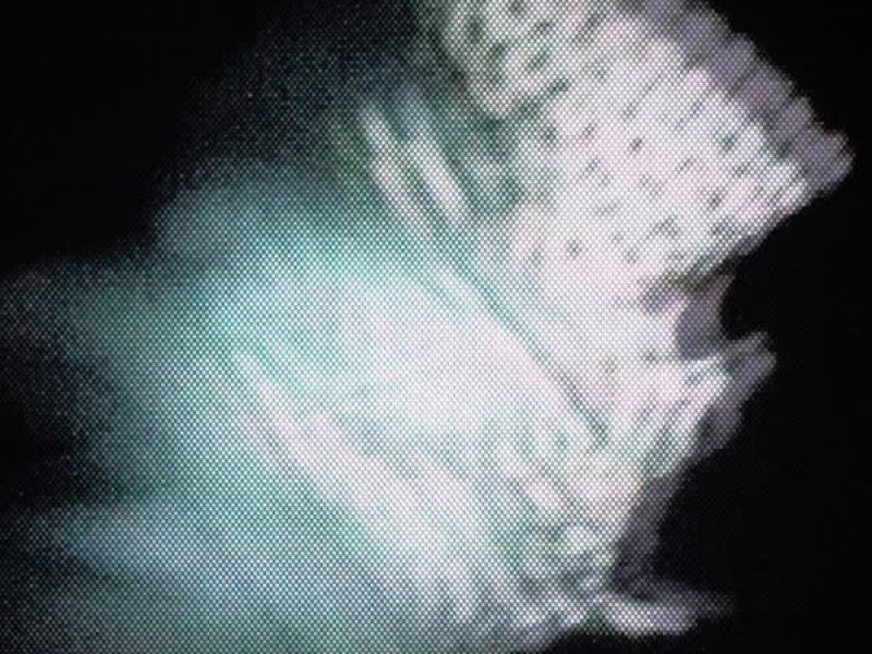 99 (Perseo) (Single)