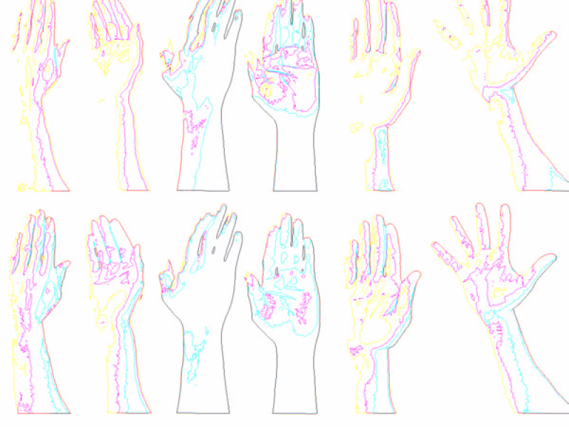 Hands Up (feat. Bam) [Kloake Remix] (Single)