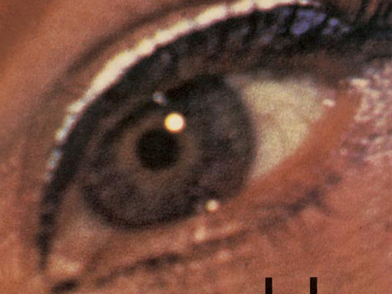 Grossas Nuvens De Amor