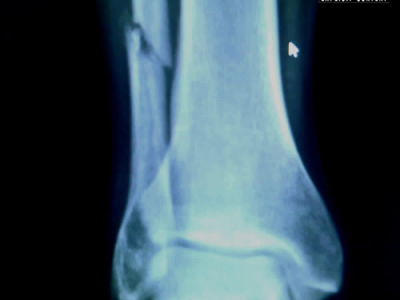 A CAMINHADA (Single)