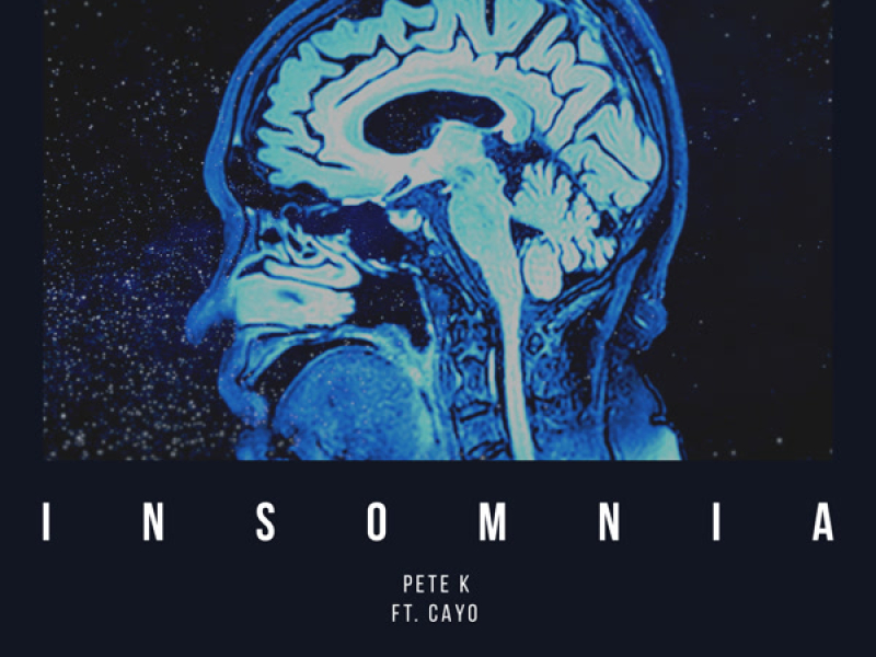 Insomnia (Radio Edit) (Single)