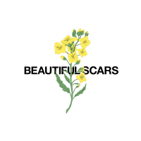 Beautiful Scars (Acoustic)