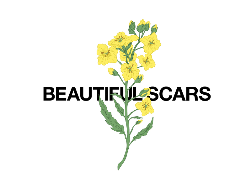 Beautiful Scars (Acoustic)