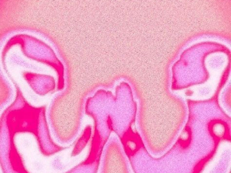 不是一定要你回來 (Single)