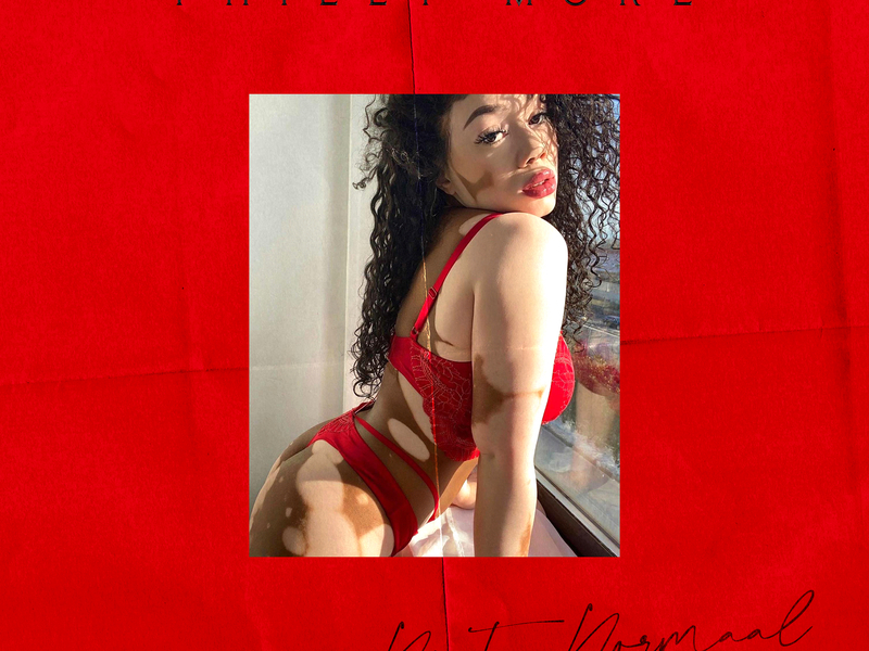 Niet Normaal (Single)